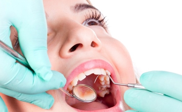 Abscessed Teeth - Symptoms Causes And Treatments #FrizeMedia