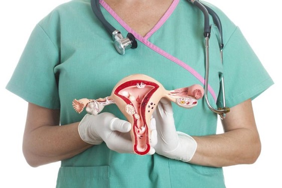 Ovarian Cancer - Hysterectomies - Be Informed About Options #FrizeMedia